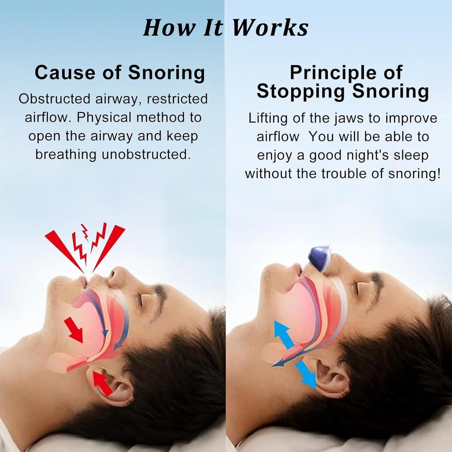 Anti Snoring Devices