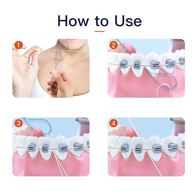 Floss Threaders for Braces, Bridges, and Implants 300 Count (Pack of 6)