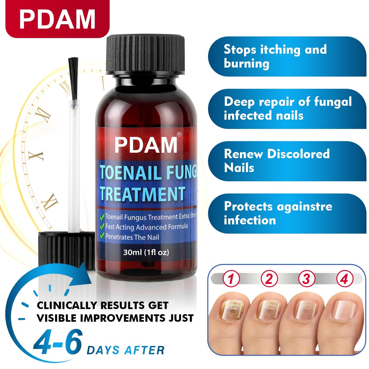 Toenail Fungus Treatment Extra Strength - Toe Nail Fungus Treatments for Thick, Nail Strengthener and Growth, Nail Fungus Treatm