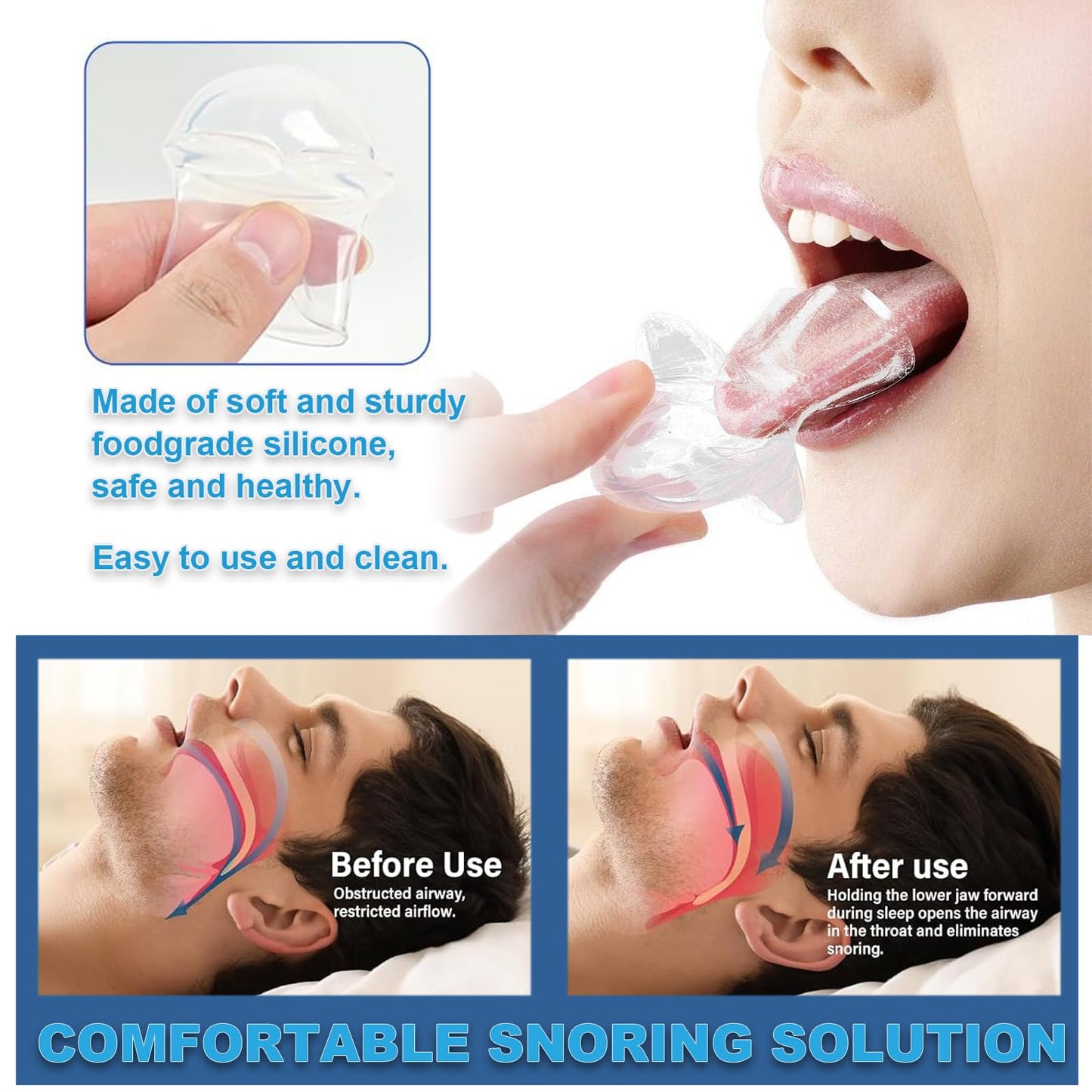 Anti-Snore Device, Reusable for Men/Women