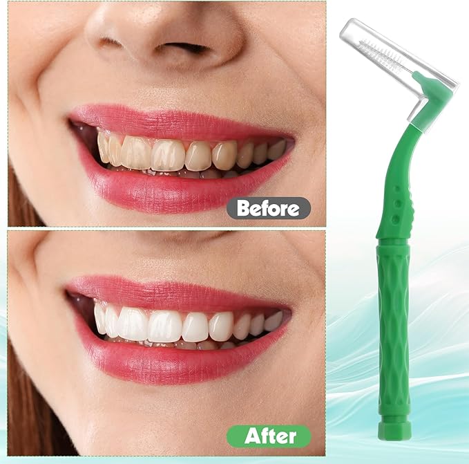 50pcs Interdental Brushes, Green Soft Dental Brushes with Non-Slip Handle Angled Head Tooth Picks Floss Sticks Dental Floss Brushes for Braces Oral Cleaning Narrow Gaps Between Teeth