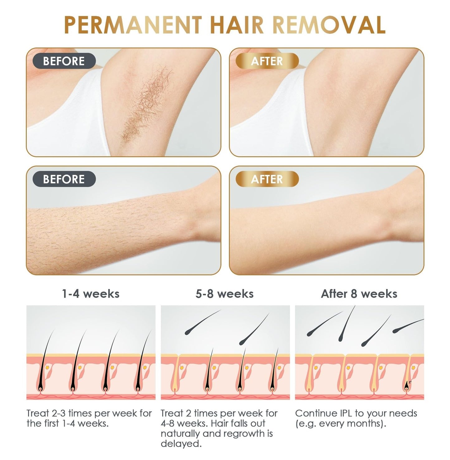 IPL Laser Hair Removal Device at-Home for Women Men NATRSYM Painless Permanent Facial Upper Lip Bikini Line Armpits Back Legs Ar