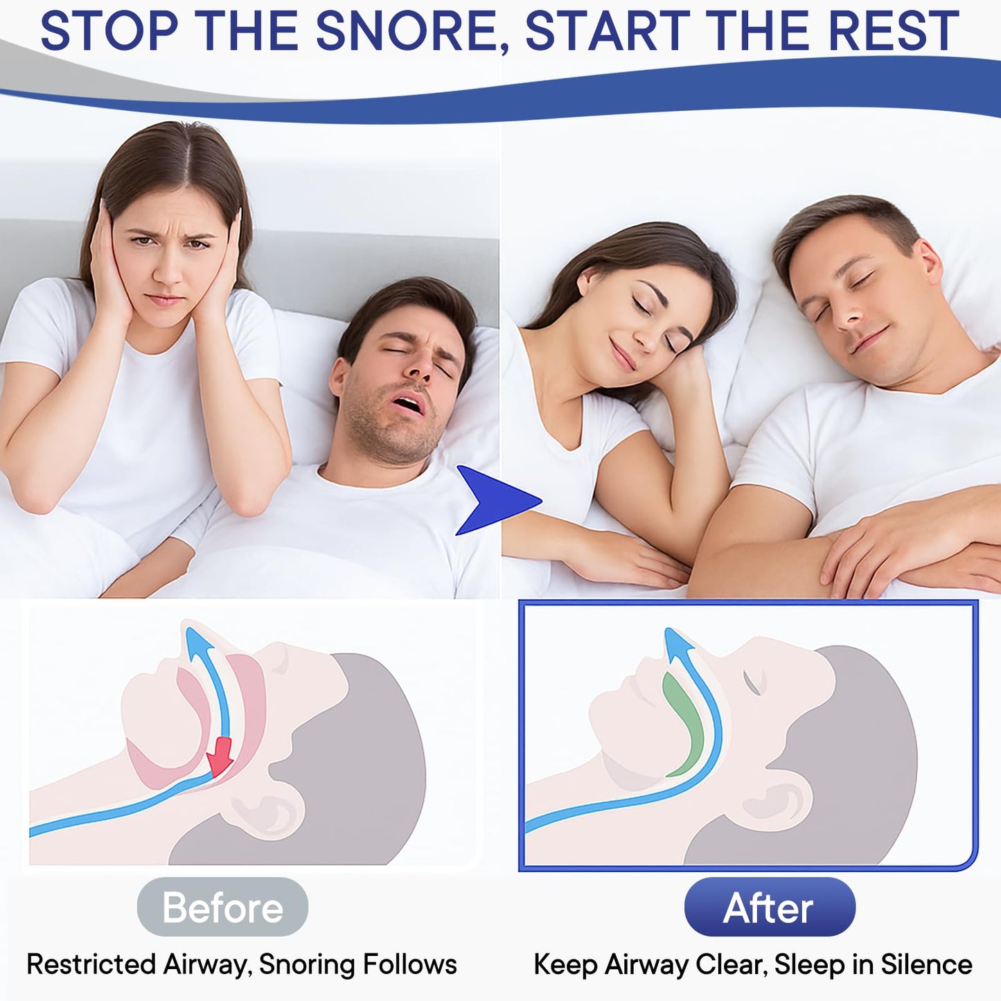 Anti Snoring Devices, Nose Vents Opener for Men and Women, 3-Gear Adjustable Fit, Individually Packaged & Portable, Helps Improve Airflow – 4 Pack