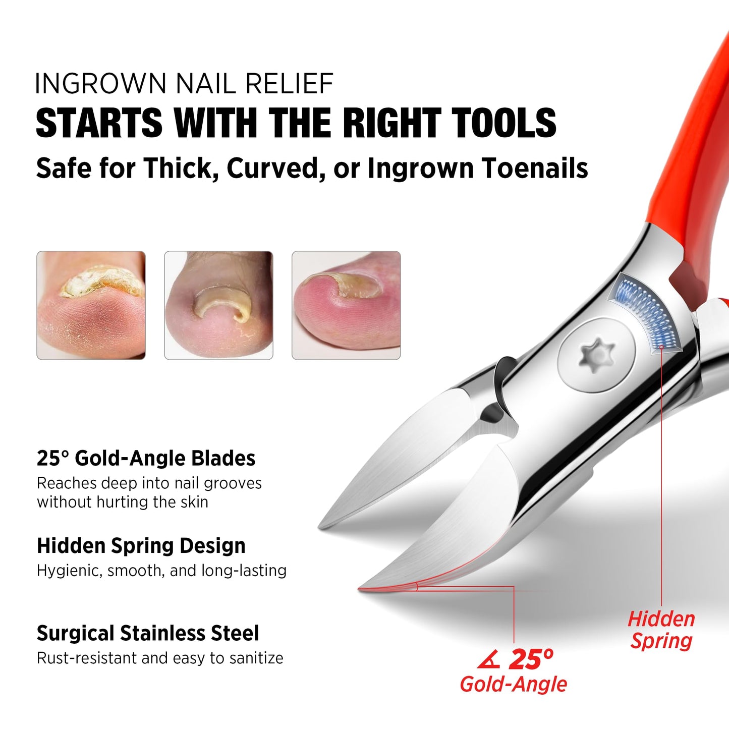 Treatonic Ingrown Toenail Clipper Removal Kit - Toenail Clippers for Thick, Fungal-Damaged, Curved Nails with Lifter & File, Lon