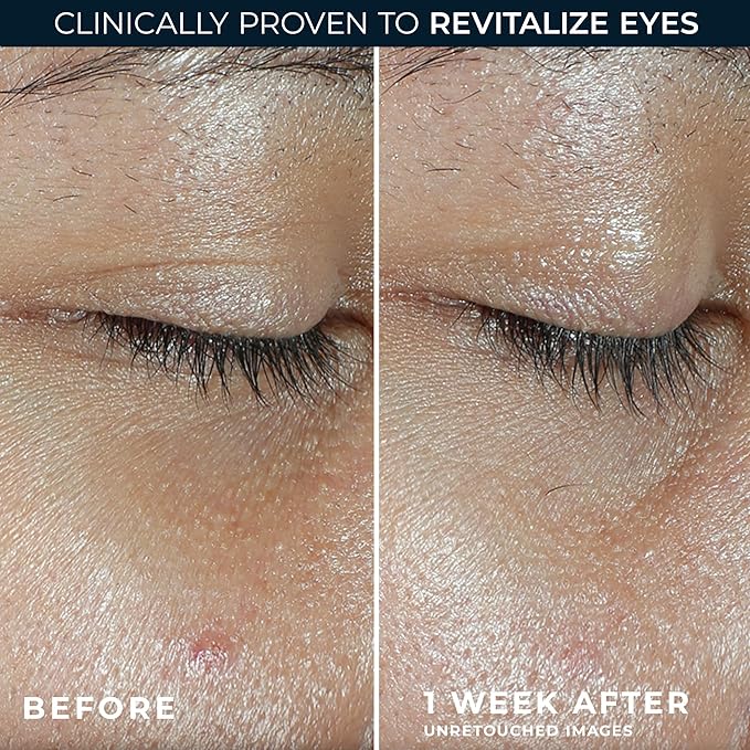 RoC Multi Correxion Revive + Glow Vitamin C Eye Balm (0.14 oz) with Retinol Eye Cream Packette