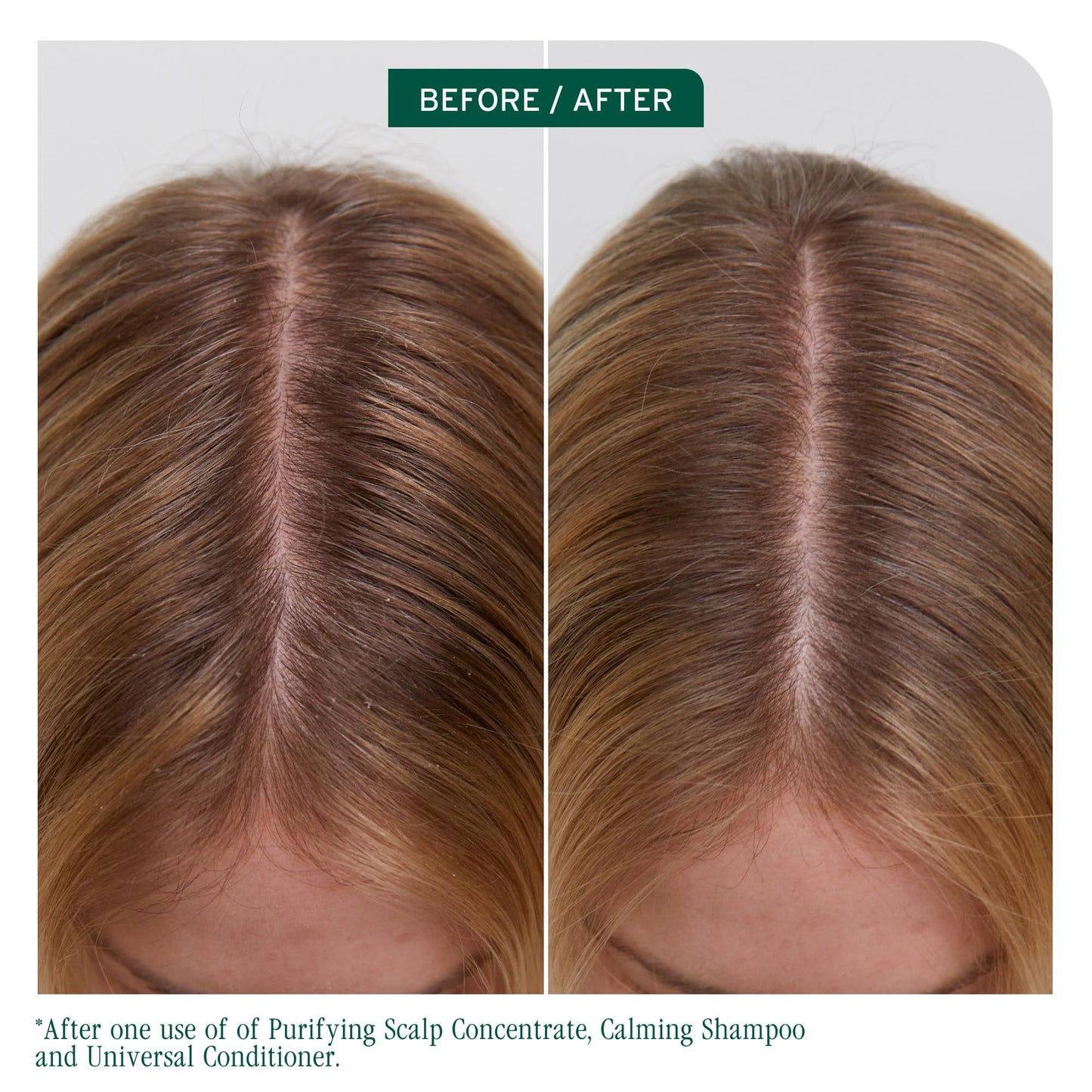 BIOLAGE Scalp Sync Universal Conditioner - Nourishing & Hydrating for All Scalp Types, Lightweight Conditioning, Fermented Tea B
