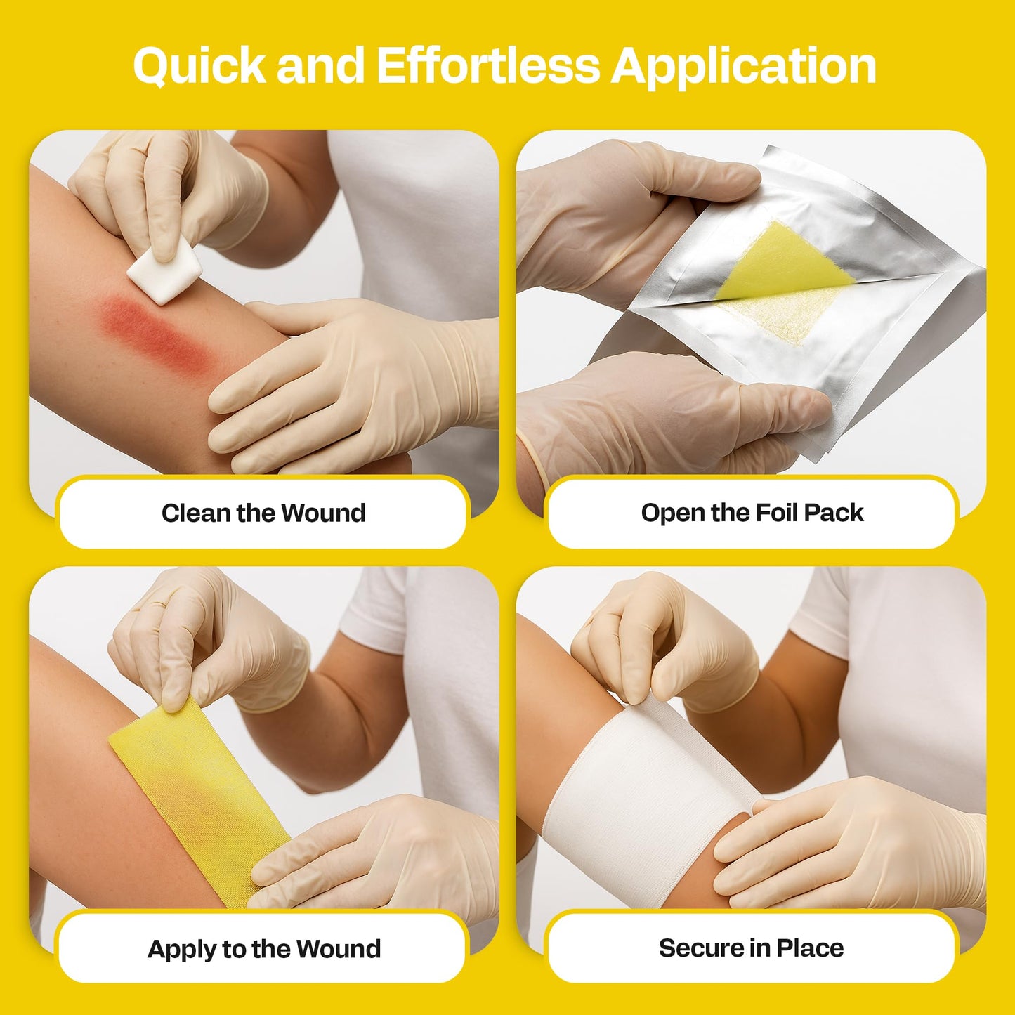 AWD Medical Xeroform Petrolatum Dressing 5x9 - Non-Adhering Gauze Pads - Fine Mesh Gauze Patch Sterile - Healthcare Supplies for Wound Care, Burns, Lacerations, & Skin Grafts Aide (Box of 25, 5"x9")
