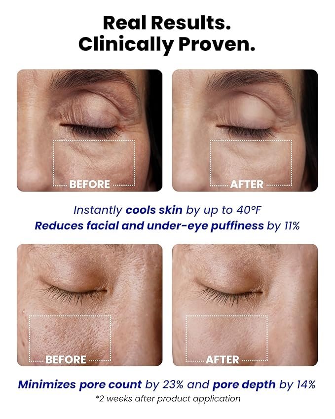 Ice Roll Serum | Cooling Face Roller with Serum for Depuffing, Under Eye Bag, Hydrating, Soothing & Pore Tightening with Panthenol & Tannin | Korean Skin Care & Gua Sha Facial Tool | 1.69 Fl Oz