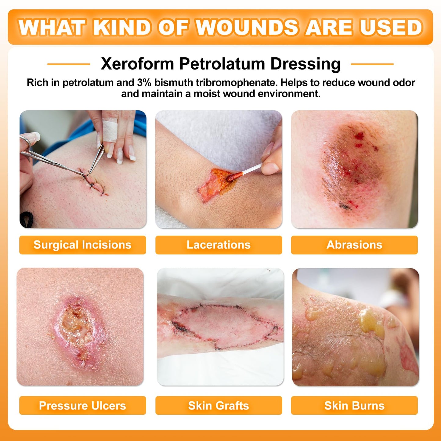 Carbou 4"x4" Medical Xeroform Petrolatum Dressing, Non-Adherent Gauze Pads, Soft Fine Mesh Gauze Patch for Wound Care, Burns, Lacerations, Skin Grafts & Surgical Incisions, 25 Individual Pack