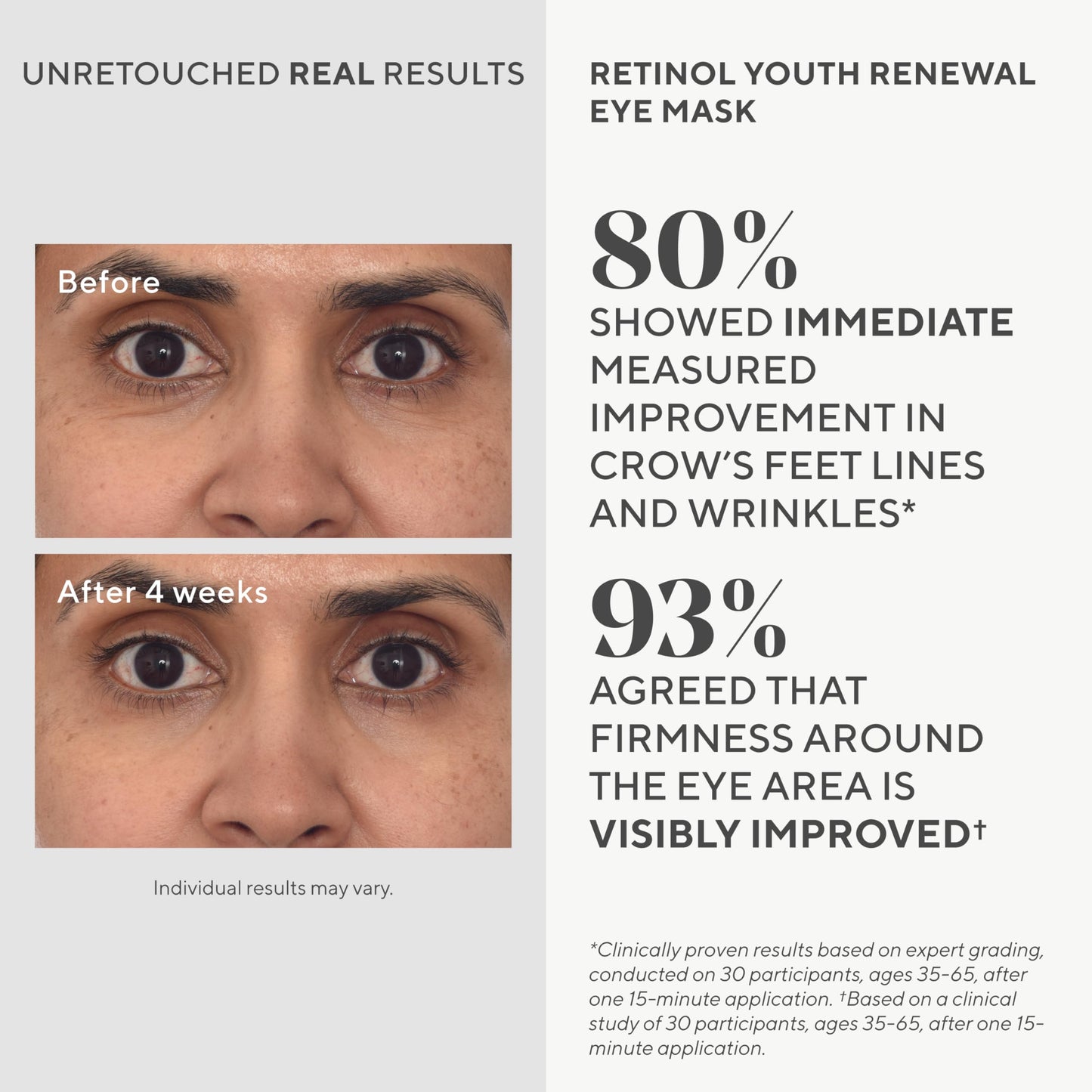 Murad Dr. Zion Retinol Youth Renewal Eye Masks - No-Slip Under Eye Patches for Fine Lines, Wrinkles, Crows Feet and Puffy Eyes -