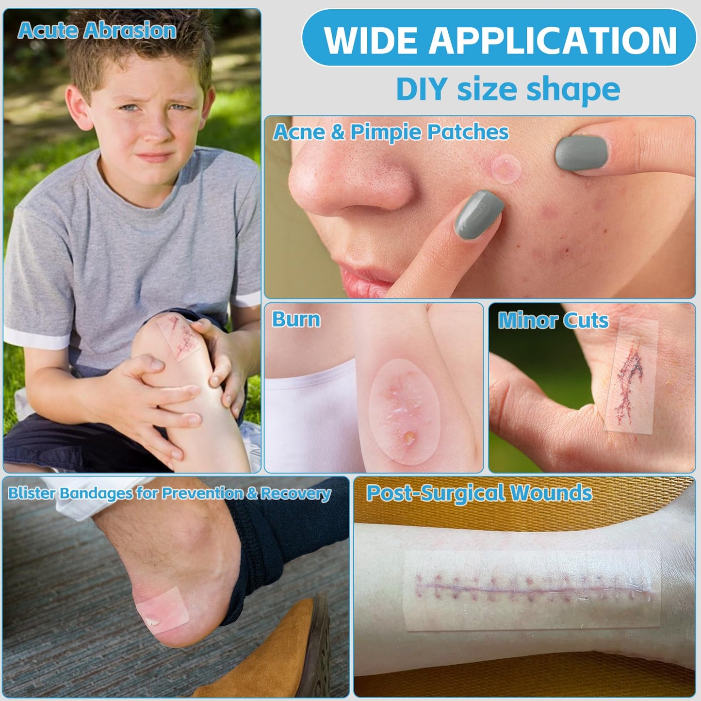 Hydrocolloid Bandages for Wound Care, Medical-Grade Hydrocolloid Roll with Self-Adhesive, Ultra Absorbent, Flexible & Waterproof, Cut-to-Size First Aid Kit Essential (2in*4.8ft)