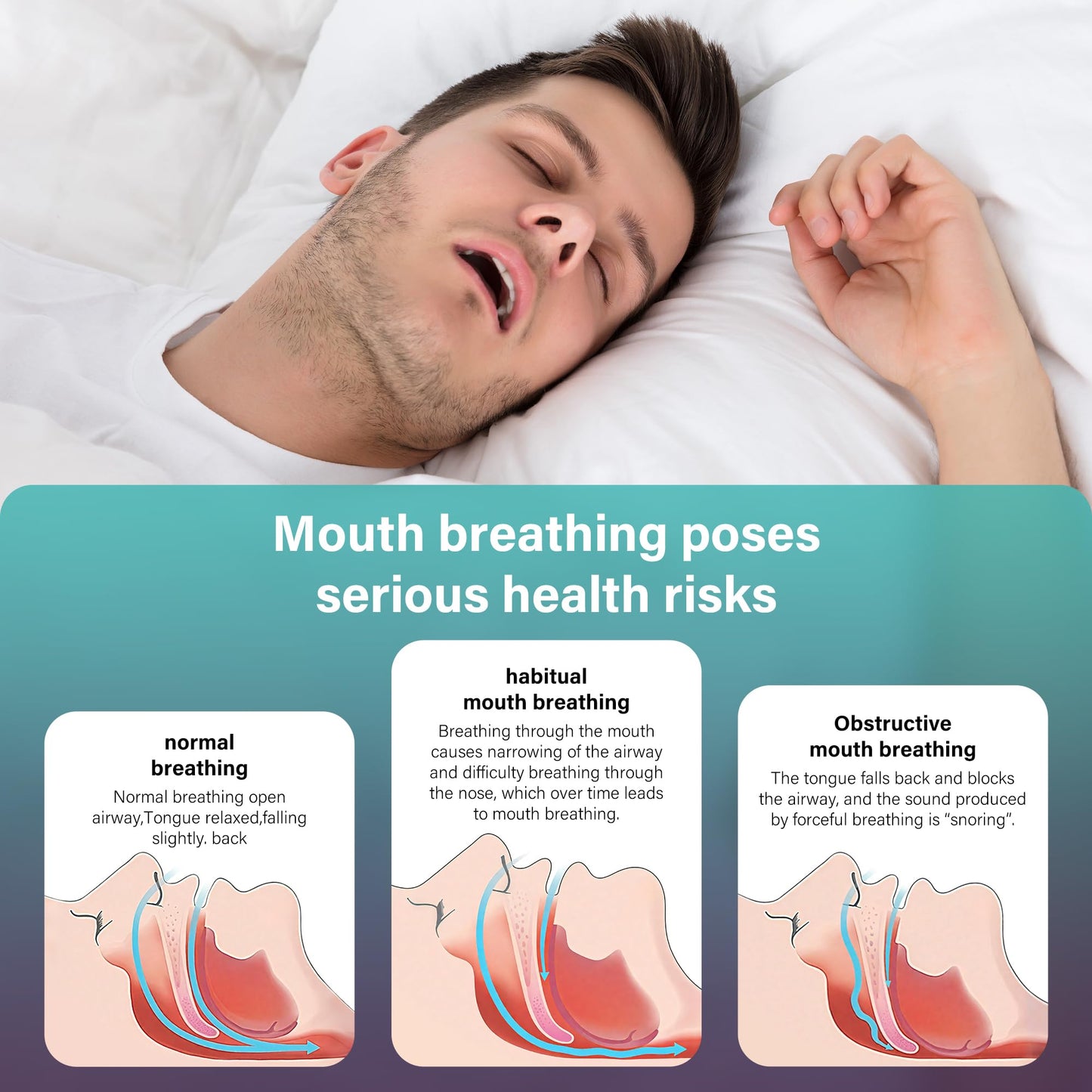 120pcs Mouth Breathing Correction Patch, Children's Closed Mouth Patch, Adult Anti-snoring, Closed Mouth Patch, Improve Mouth Breathing Facial Problems (Pink, 120pcs-Ages 16+)
