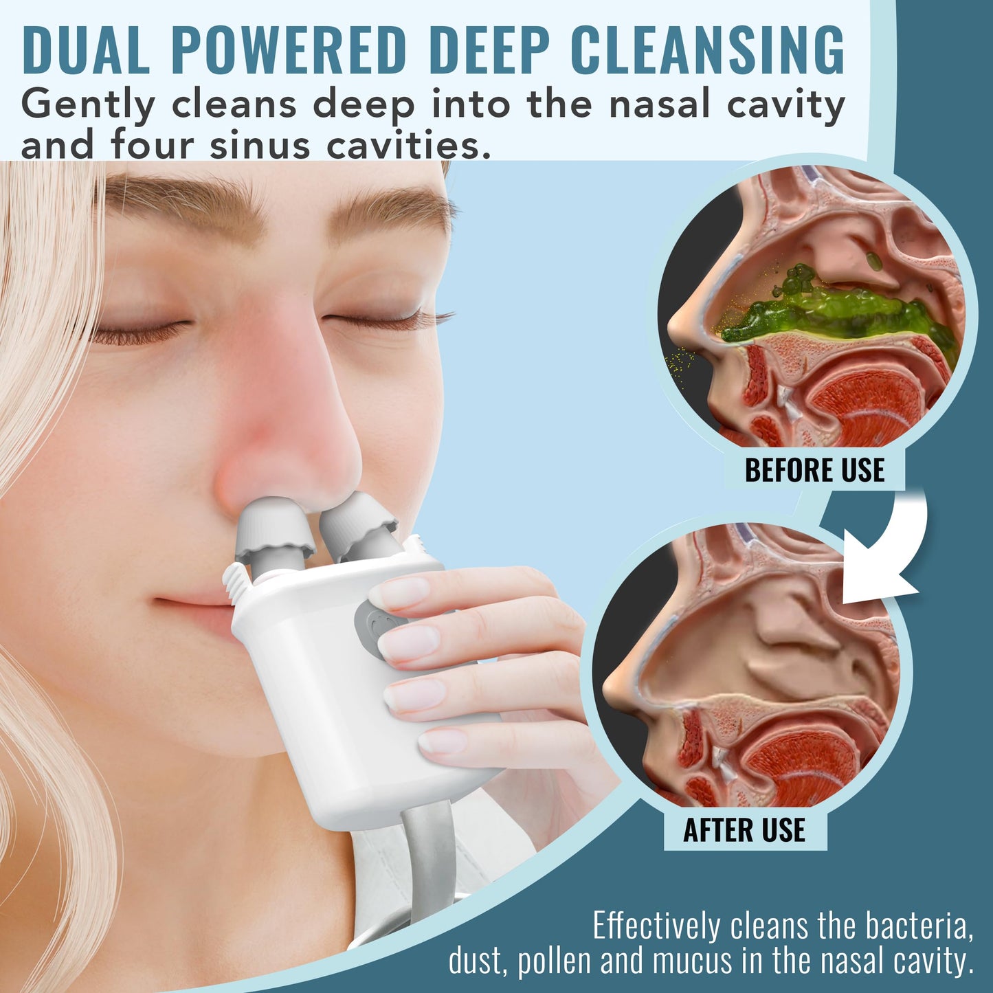 NASALFRESH MD - Dual Powered Nasal Irrigation System Nasal Rinse and Wash - Sinus Decongestant Relief System w/ 30 Saline Packets - Rechargeable - 2 Sets of Nose Pillows - Snoring Remedy