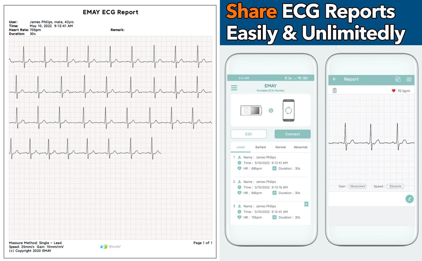 EMAY Portable ECG Monitor | Record ECG and Heart Rate | Compatible with Smartphone and PC