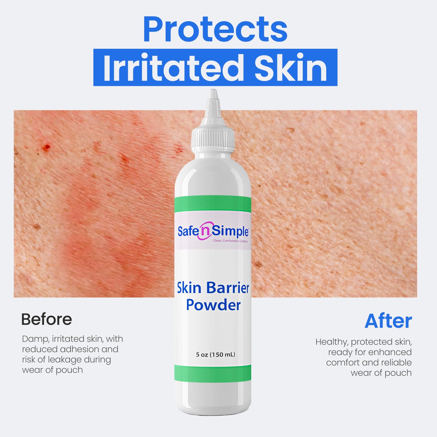 Safe n' Simple Stoma Skin Barrier Powder - 5 oz - Medicated Protective Skin Barrier - Ostomy Protection Supplies - Stoma Adhesive Powder