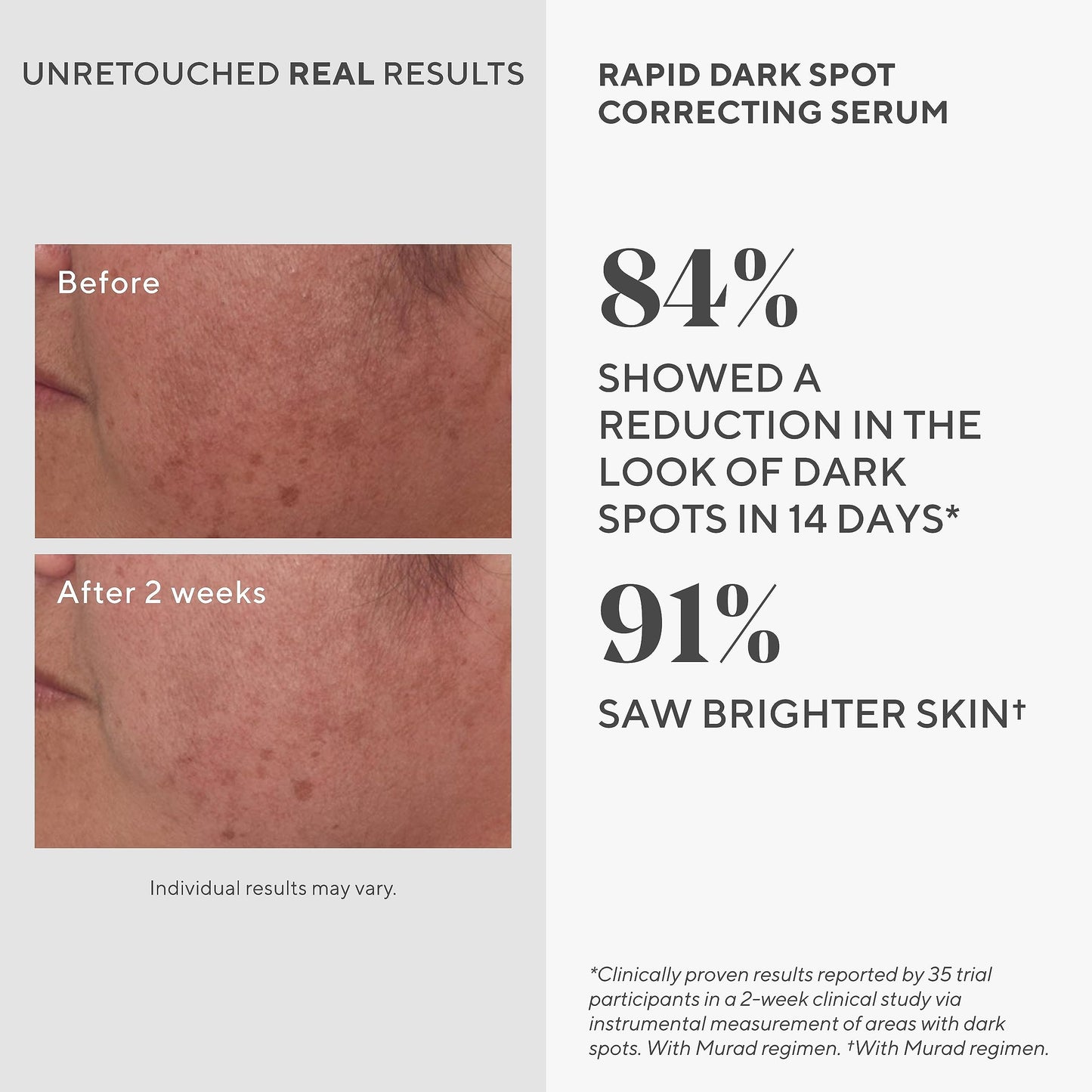 Murad Rapid Dark Spot Correcting Serum - Skin Brightening Face Serum for Hyperpigmentation - Dark Spot Remover for Face - Glycol