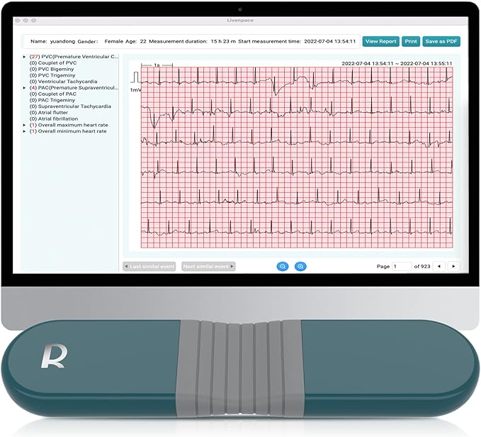Livenpace 1-Lead Heart Health Monitor at Home, Portable 24 Hours Chest Lead Device with Free AI Analysis & PC Report, Rech...