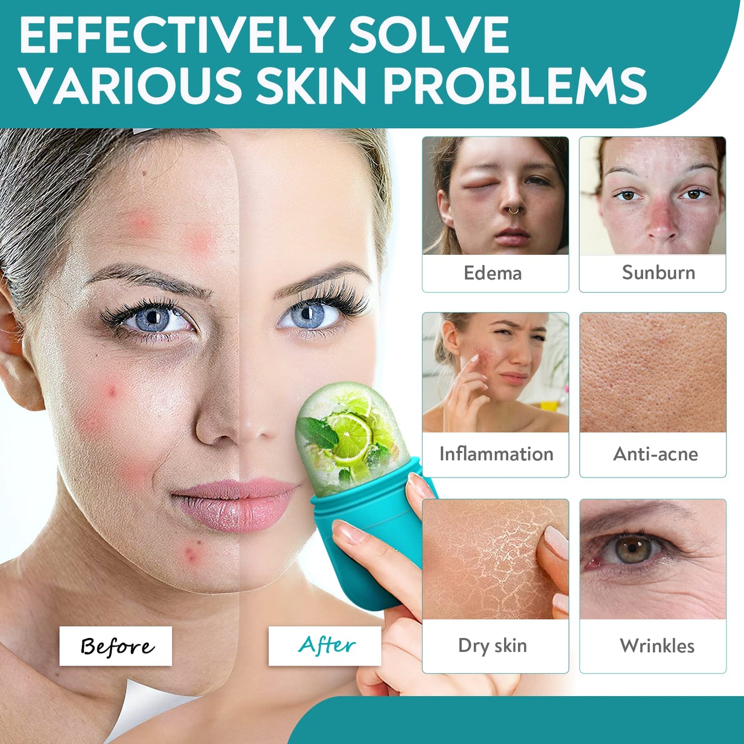 AURUZA Ice Face Roller and Gua Sha Set, Facial Ice Roller & Gua Sha Massage Tool for Face & Eye Puffiness Relief, Shrink Pores,