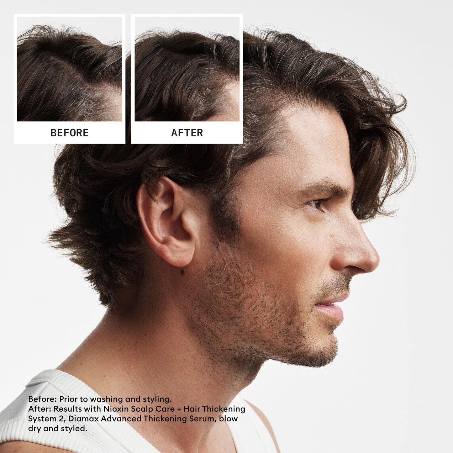 Nioxin Scalp + Hair Thickening System 2 Leave on Treatment, For Natural Hair with Progressed Thinning, 6.8 oz (Packaging May Var